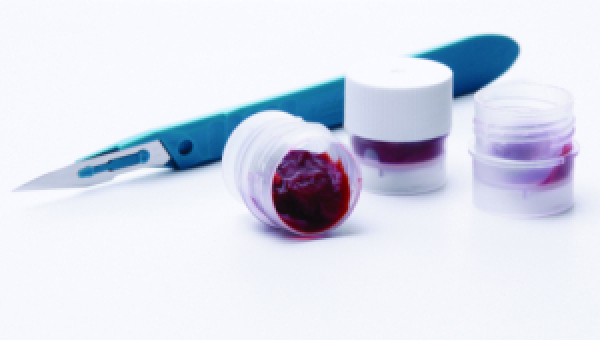 Kryo-Geweber�hrchen- CryoELITE Tissue Vial